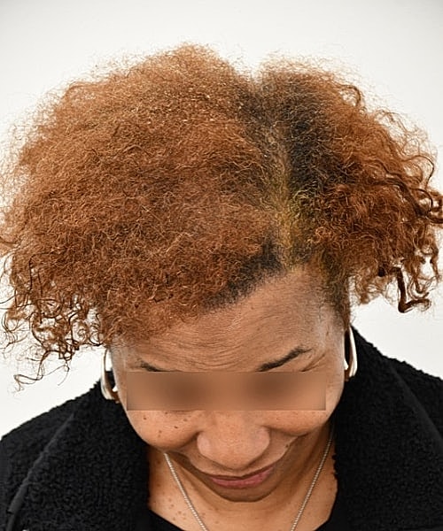 Hair with curly texture and reddish-brown color.