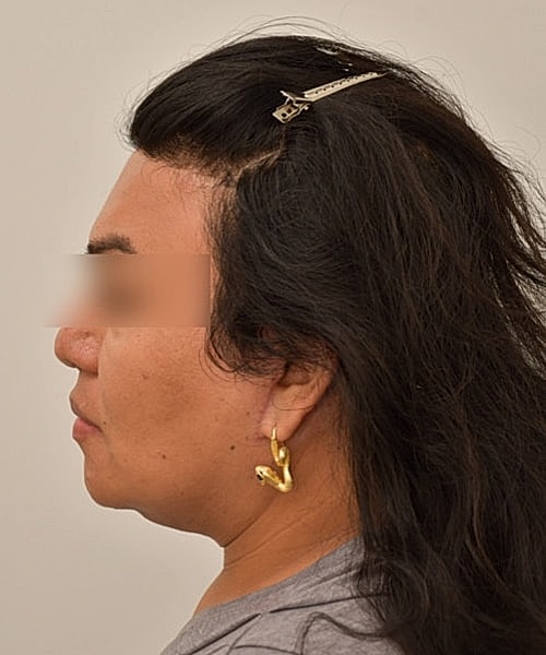 Profile view of person with long hair.