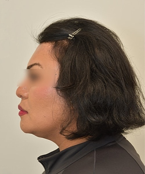 Profile of a person with dark, shoulder-length hair.