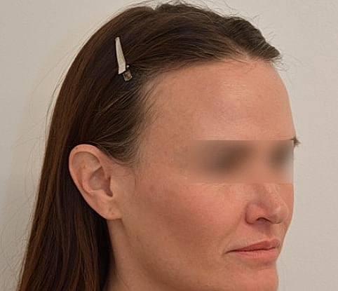 Woman with hair clip, profile view.