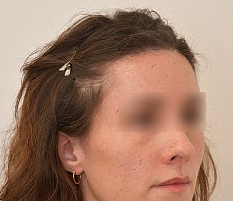 Profile view of a woman with hair clip.