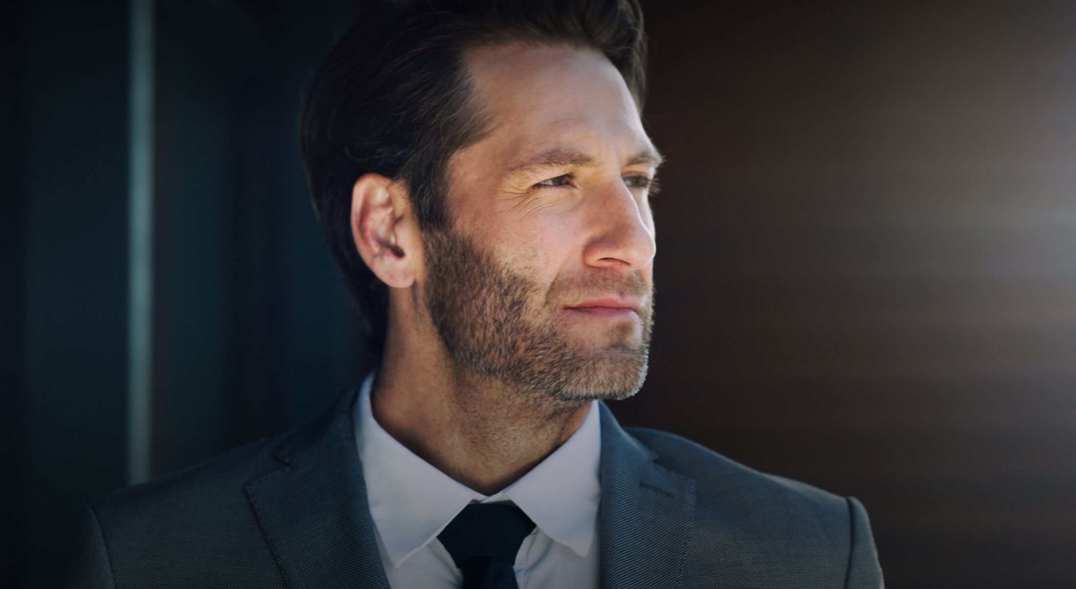 San Francisco Hair Transplant model wearing a suit